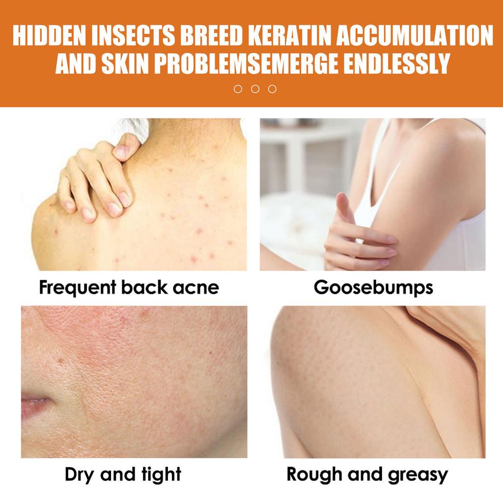 Eelhoe Turmeric Body Scrub For Smooth Skin Exfoliation And Dark Spot Treatment