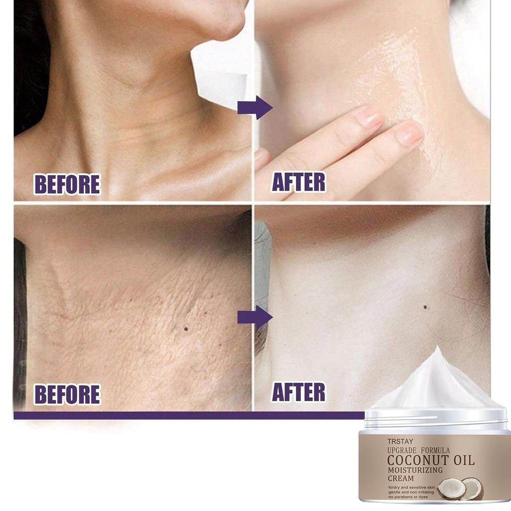 Whitening Essence Cream, Brightening and Anti-aging, Vitamin Coconut Oil, Supplement Strong Moisture, Moisturizing and Moisturizing Cream