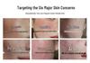 Revitalizing Spot Removal Cream: Fade Dark Spots, No Residue, Skincare Salon-Quality