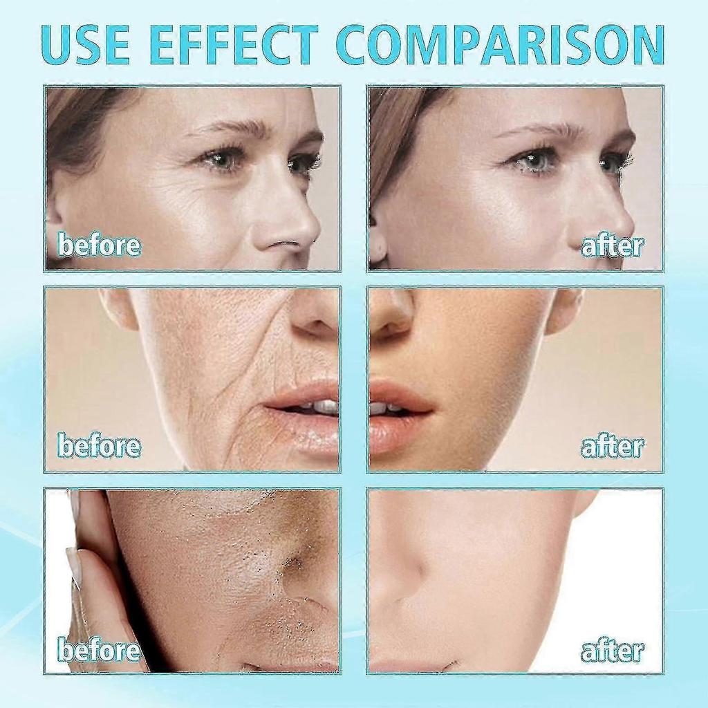 OUHOE Hyaluronic Acid Anti-Aging Gel Mask Fades Fine Lines, Moisturizes Skin, Hydrating and Moistur