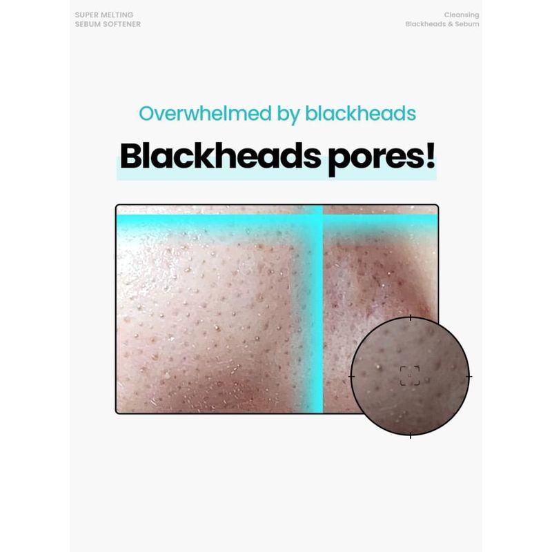 ilso - Super Melting Sebum Softener Special Set