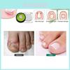 Hbesty High-quality Nail Bed Protector Set For Toenail Care With Herb Scent 10 Pieces