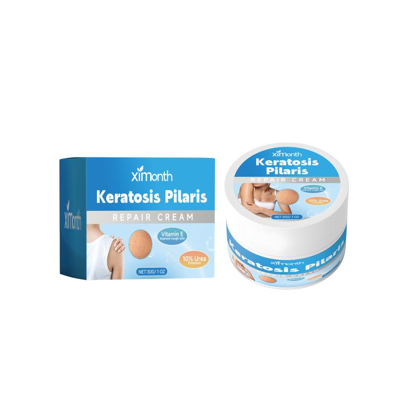 Repair Treatment Cream Exfoliating Removal Chicken Skin Cleaning Acne Spots Moisturizing Smooth Body Skin Care