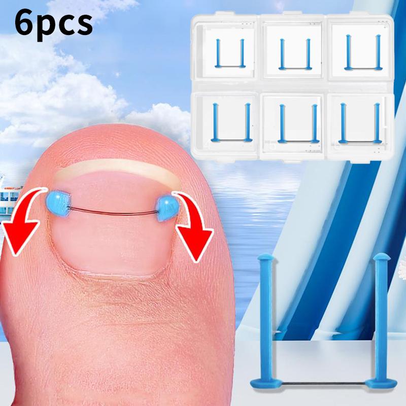Ingrown Toenail Blue Correction Wire Set Foot Care Professional Treatment Recover Embed Toe Nail Pedicure Straightening Toe Tool