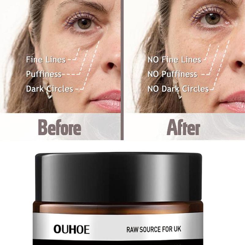 Okamžité odstranění očních váčků Krém, Retinolový krém, Proti otokům, Vráskám, Stárnutí, Stahuje kruhy, Oddaluje Redukuje Tmavý Gel