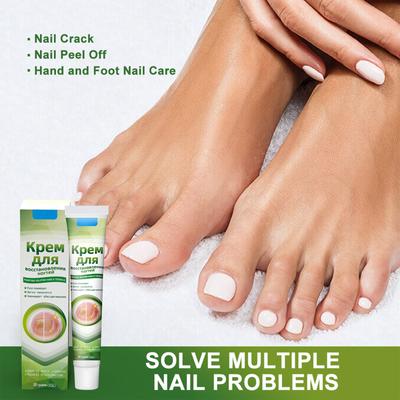 Plaster, Gray Nail Cream, New Bright Potassium Nail Cream, With File