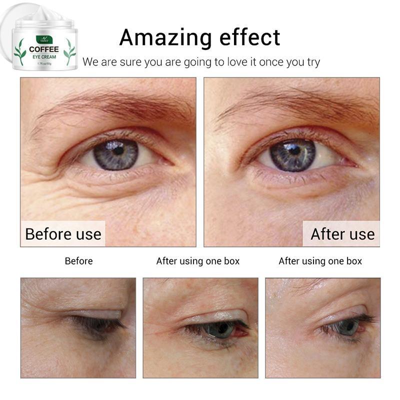 Sofortige Entfernung von Falten, Retinol-Gesichtscreme, Lifting, Anti-Aging, Anti-Augentaschen, Feuchtigkeitscreme, Gesichtsbehandlung, koreanische Pflege