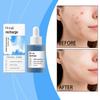 Blue Copper Peptide Facial Serum Anti-Aging Treatment Helps Firm Skin Deep Hydration Gentle Care Improve Skin Texture Brighten