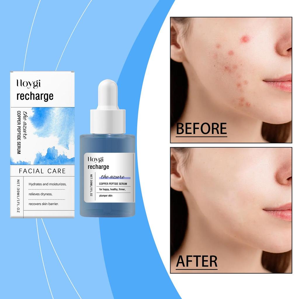 Blue Copper Peptide Facial Serum Anti-Aging Treatment Helps Firm Skin Deep Hydration Gentle Care Improve Skin Texture Brighten