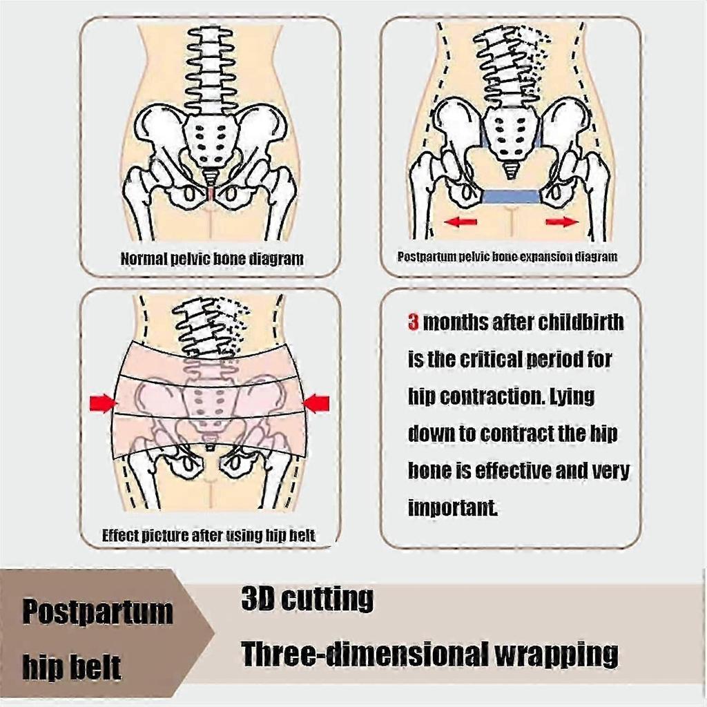 Anterior Pelvic Tilt Correction Belt, Postpartum Recovery Belt Women Pelvic Correction Belt, Adjustable Women Relief From Sciatica Pelvis(beige,small)
