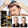 EELHOE Hair Growth Ginger Essential Treatment Scalp Dry Frizz Damaged Hair Anti Hair Loss Hair Care Serum Fas