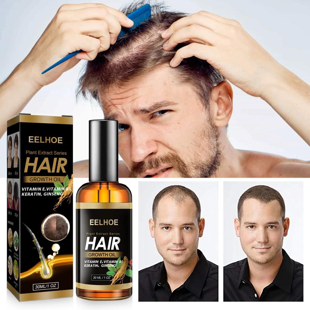 EELHOE Hair Growth Ginger Essential Treatment Scalp Dry Frizz Damaged Hair Anti Hair Loss Hair Care Serum Fas