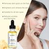 Niacinamide Face Serum Dark Spots Removal Brightening Rejuvenating Fade Melasma Hydrating Anti Wrinkle Vitamin B3 Essence