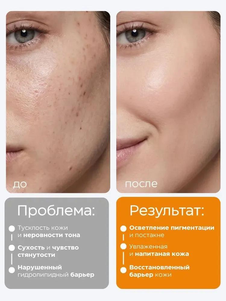 Dr.Althea Face cream, lightening, pigmentation and postacne, with tranexamic acid and niacinamide, 20 ml
