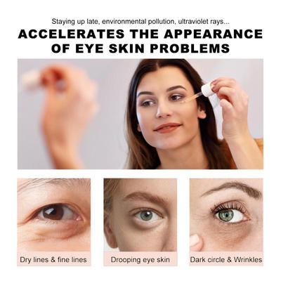 Retinol Eye Serum Diminishes Fine Lines, Puffiness, and Dark Circles, Leaving the Skin Around the Eyes Firm and Supple