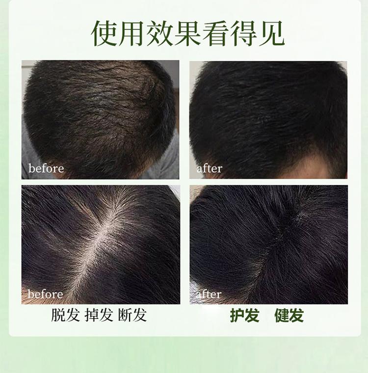 3 Sets of Polygonum Multiflorum Shampoo Soap for Hair Care