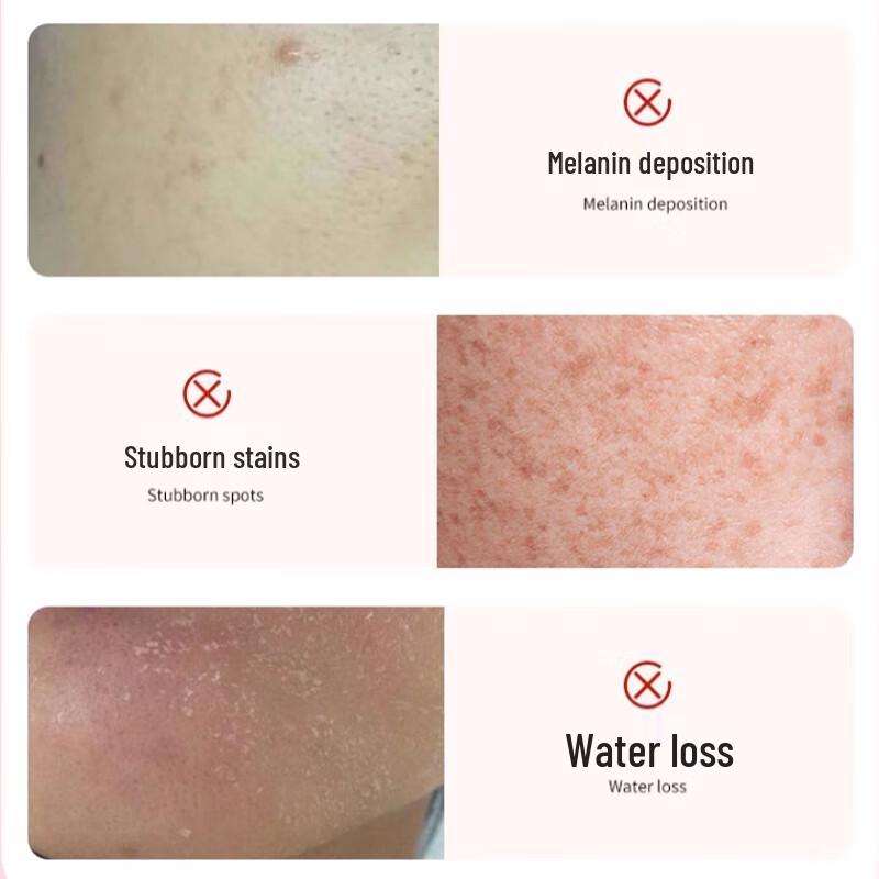 Lamei L-Ascorbic Acid Vitamin C Lotion