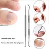 Ingrown Toenail Correction Patch Stickers Ingrown Toenail Treatment Lifter Toe Nail Patch Correction Buckle File Cuticle Pusher