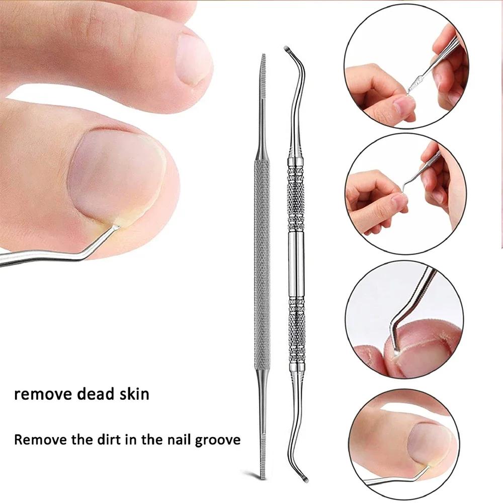 Ingrown Toenail Correction Patch Stickers Ingrown Toenail Treatment Lifter Toe Nail Patch Correction Buckle File Cuticle Pusher