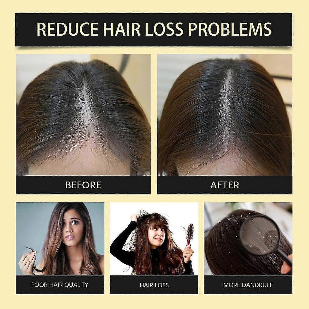 Bai Hei Ke Anti-Hair Loss Shampoo, White Hacker Shampoo & Hair Mask, Ginseng Shampoo, Hair Shampoo Against Hair Loss for All Hair Types, Multi-Purpose