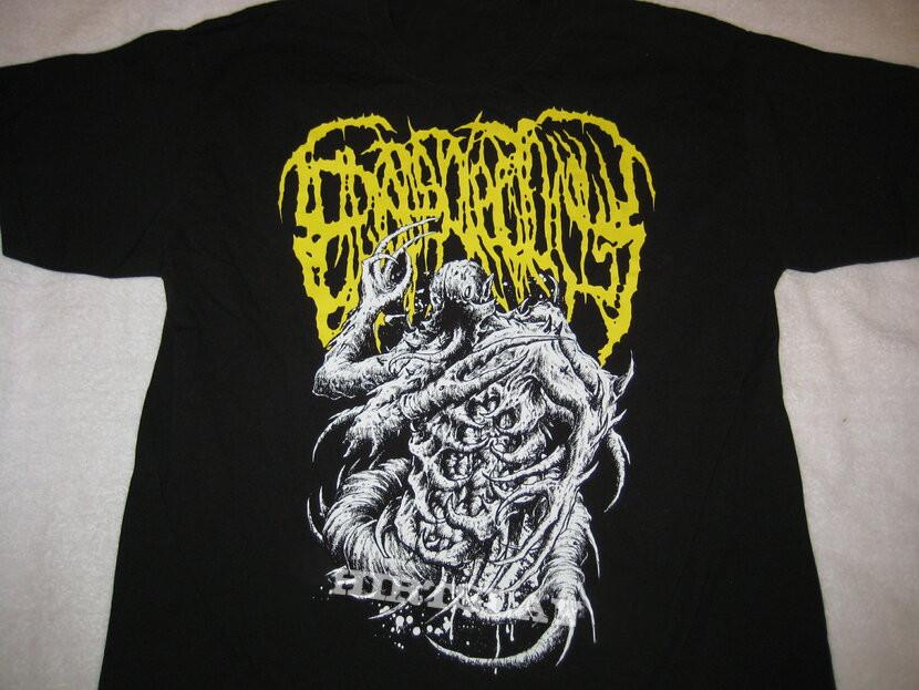 

Collection Epicardiectomy Band Tour All Size S to 5XL Unisex T-shirt MD129 Unisex T-Shirt M