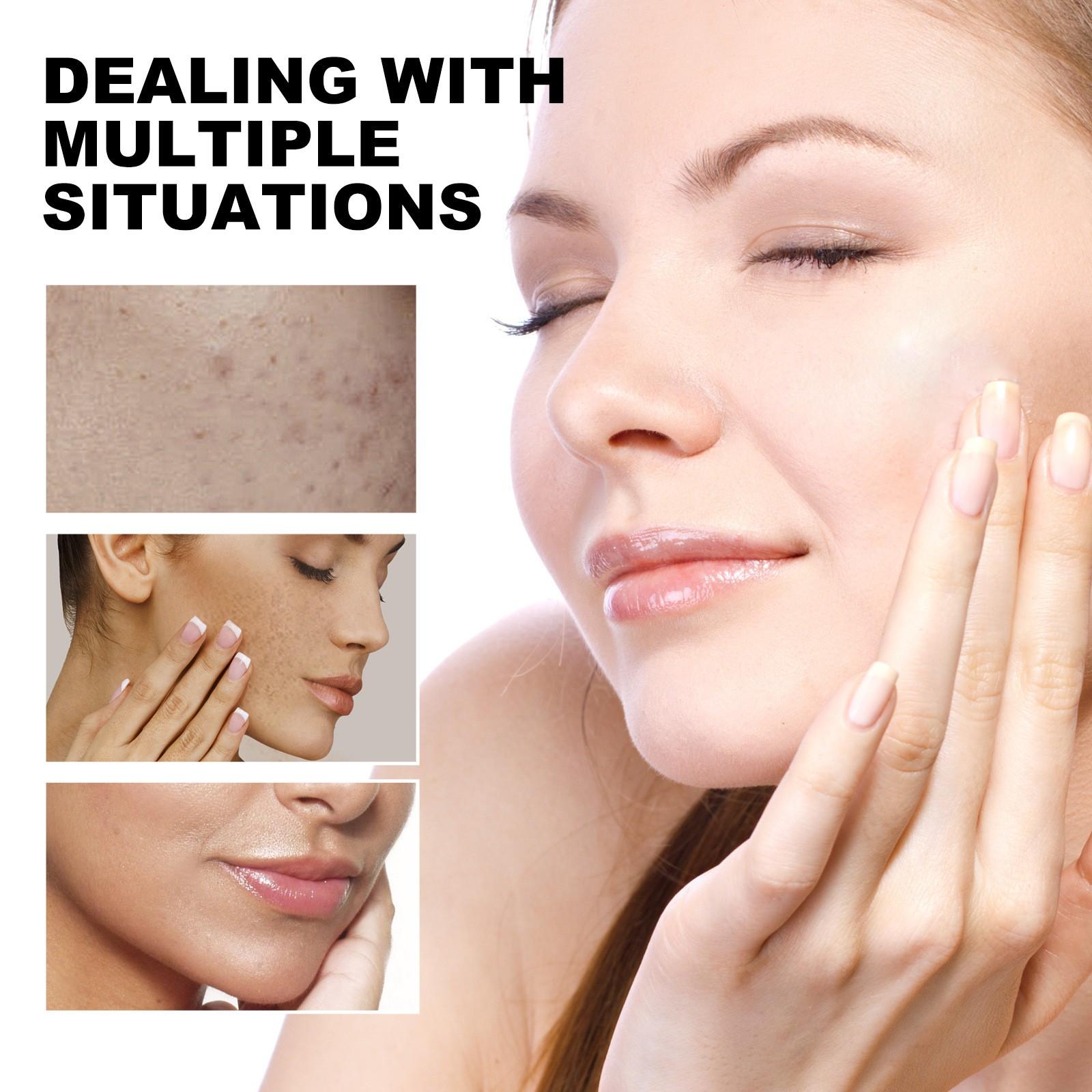 Очищающие подушечки (для удаления темных пятен) Губка для очищения лица — фото 2