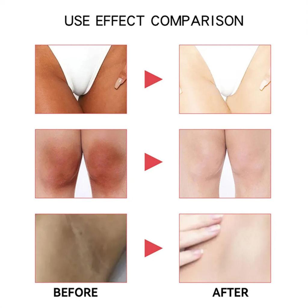 TRSTAY Foot Moisturizing Cream deeply moisturizes and nourishes your feet, softening dead skin cells