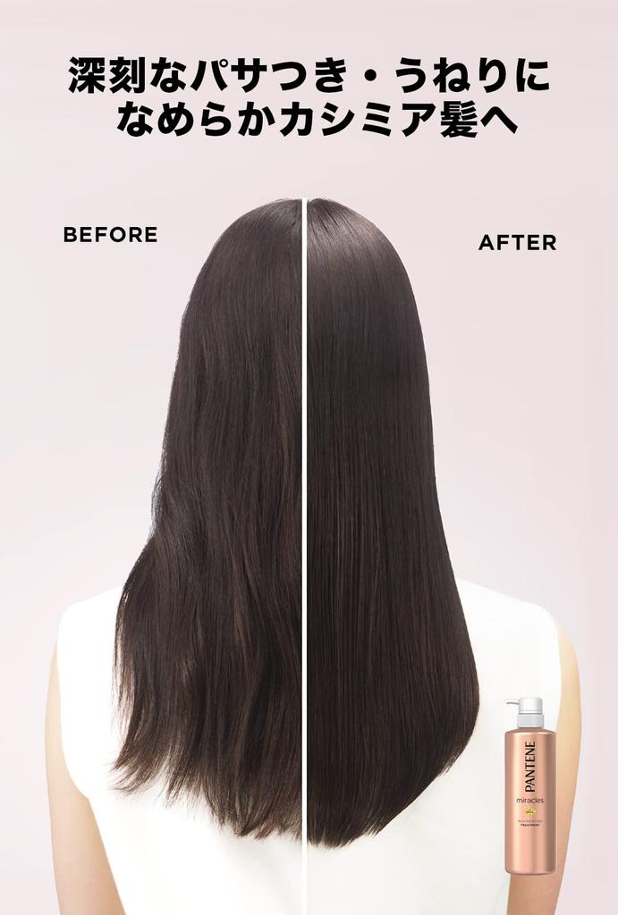 Pantene Treatment Miracles Rich Moisture Refill 440g