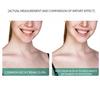 Neck Beauty Instrument - Anti-Wrinkle, Lifting, LED Light Therapy, EMS, 45°C Heat, Rechargeable