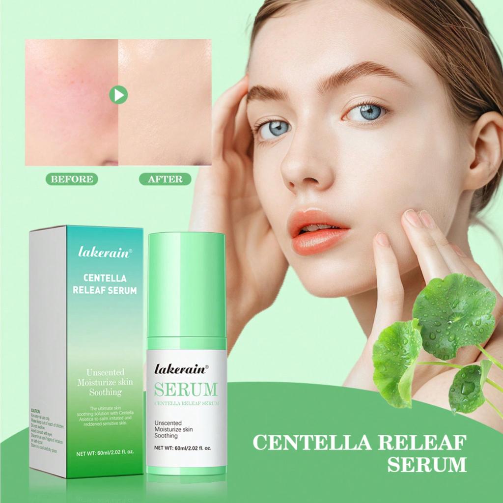 1 Centella Asiatica Soothing Essence 60 Ml Soothes The Skin Barrier Gentle Skin Care Repairs The Skin Moisturizes and Soothes The Skin