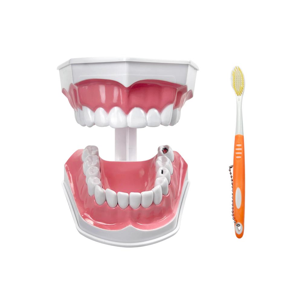 1pcs Dental Caries Model Plastic Dental Model Teeth Brushing Model Dentistry Teeth Model With Toothbrush For Studying Teaching