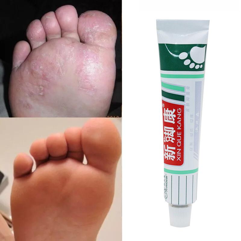 New Relief Foot Cream Remove Foot Odor Ointment To Inhibit Foot Bacteria Deep Repair
