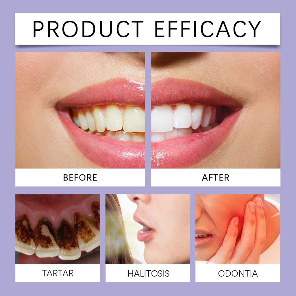 Purple Teeth Whitening Mouthwash Gentle Ingredients  Teeth, Clean Stains And Remove Odors(30ml)