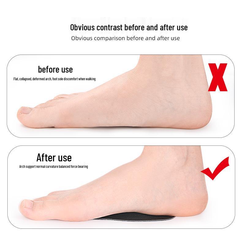 Latex Leather Arch Support Pad: Soft, Self-Adhesive, Anti-Abrasion Insole for Flat Arch, Valgus, and Varus Support