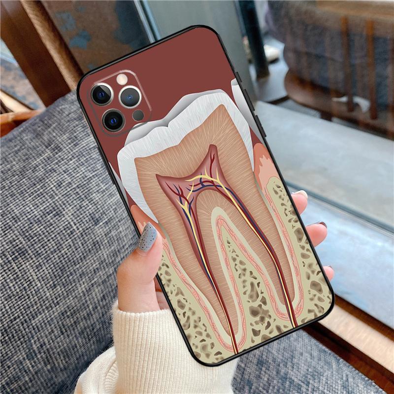 Human Tooth Anatomy Phone Case For iPhone 16 15 14 12 11 13 Pro Max 12 13 Mini XR 15 16 Plus 16e Cover Shell
