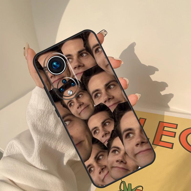 

Teen Wolf Dylan Obrien Case For Honor Magic 8 7 6 5 Pro Cover For Honor X9c X9b X9a X8a X8b 50 70 90 200 400 Lite Honor X8b