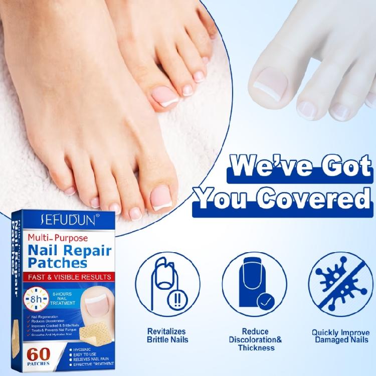 Ingrown Toenail Sticker Corrector Patches Big Toe Nail Corrector Renewal Plaster