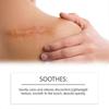 Keloid Bumps Removal Gel, Advanced Scar Gel for Face & Body, Scar Gel for All Scars & Keloids