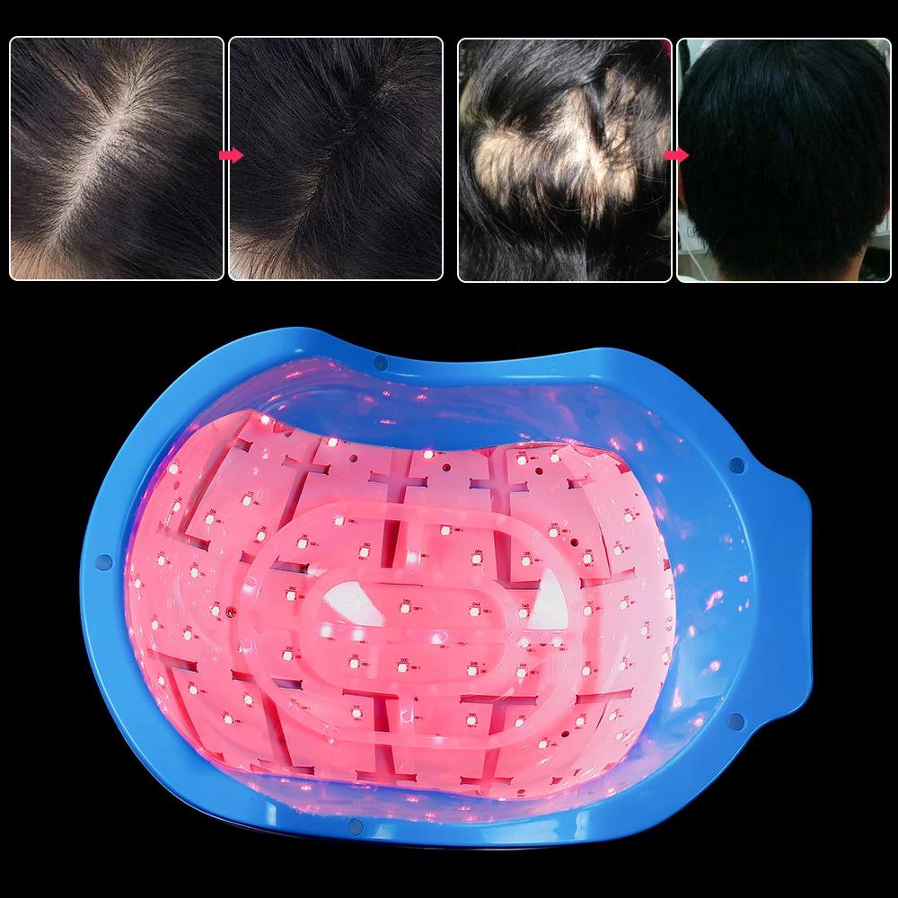 650nm LED Infrared Laser Hair Growth and Strengthening Helmet