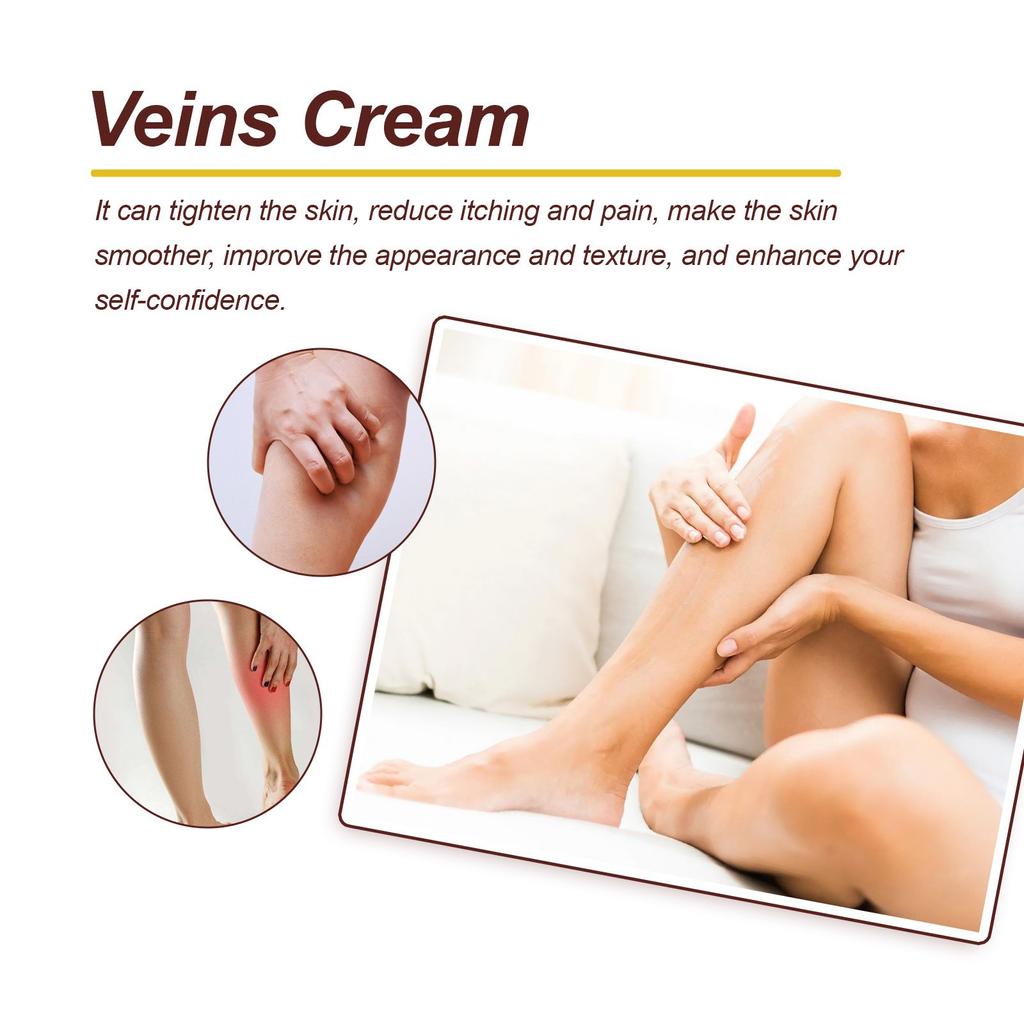 Vein Care Fading Paste -Anti Varicose Vein Soothing Leg Paste,  The Appearance Of Varicose Veins