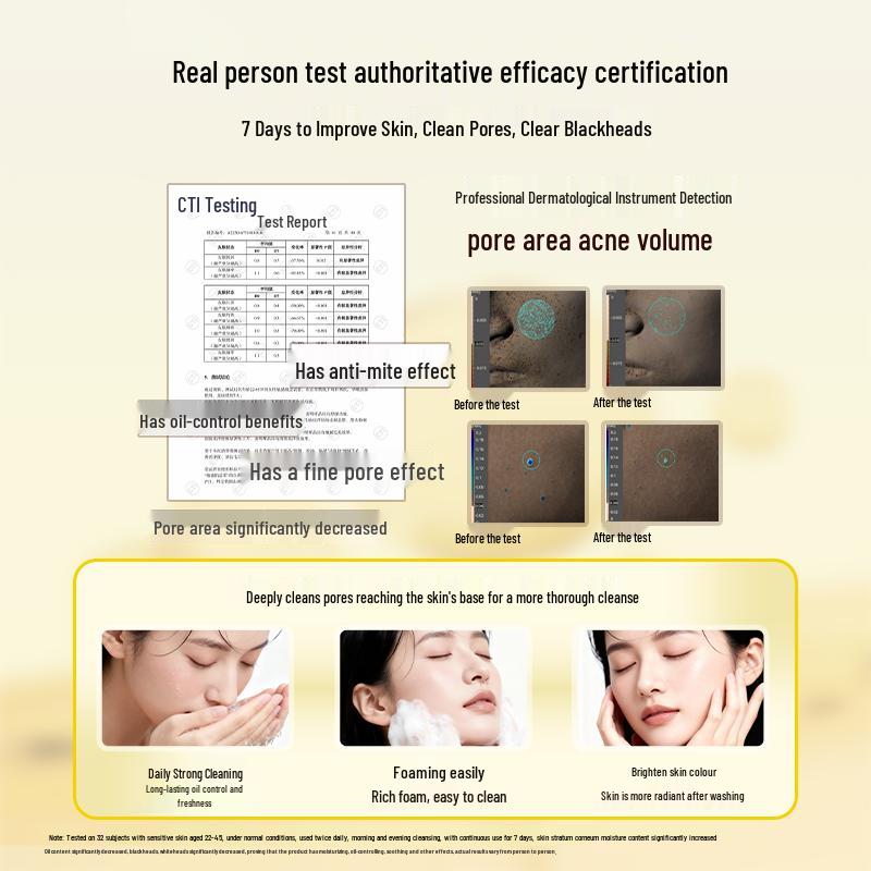 FIVERAMS Sulfur Acne & Oil Control Facial Cleanser