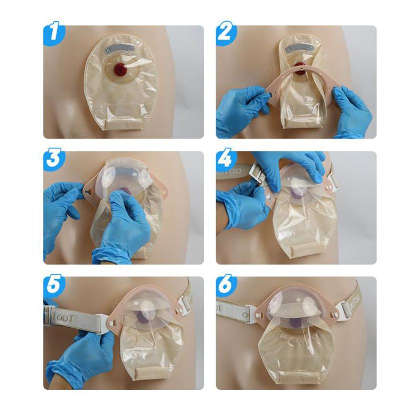 1 Set Cintura di Rinforzo Regolabile per Stoma Fissa Borsa per Colostomia Per lo Sport Cintura Elastica in Vita e Piastra di Fissaggio
