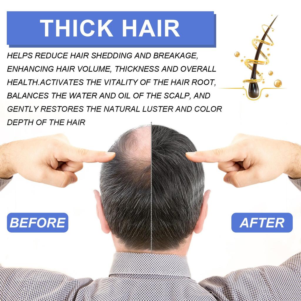 Mit Biotin angereicherter Haarwuchsschaum für superstarkes Haarwachstum, damit das Haar länger und dicker wird, 60 ml