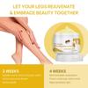 Varicose Veins, Varicose Veins, Pain Ointment, Varicose Veins, Varicose Veins