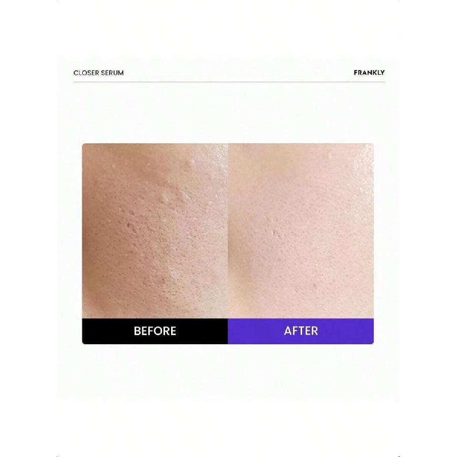 FRANKLY Closer Serum Jumbo - 60ml | Powerful Pore Minimizer Serum Infused With 9 Peptides, Vegan Collagen, Adenosine, And Pha
