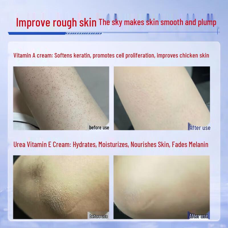 DAGO Vitamin A & E Urea Cream Set