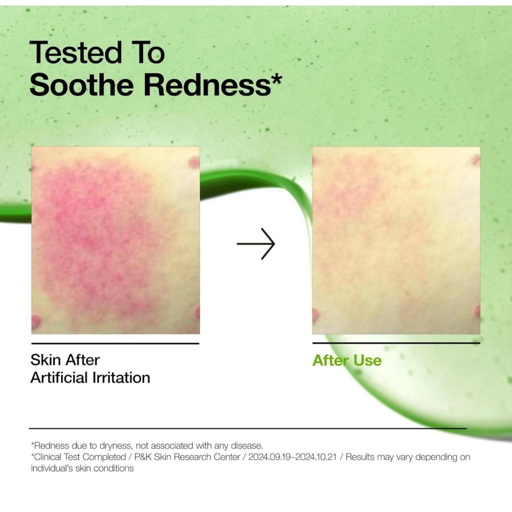 Anua Azelaic Acid 10 Hyaluron Redness Soothing Serum, 30mL