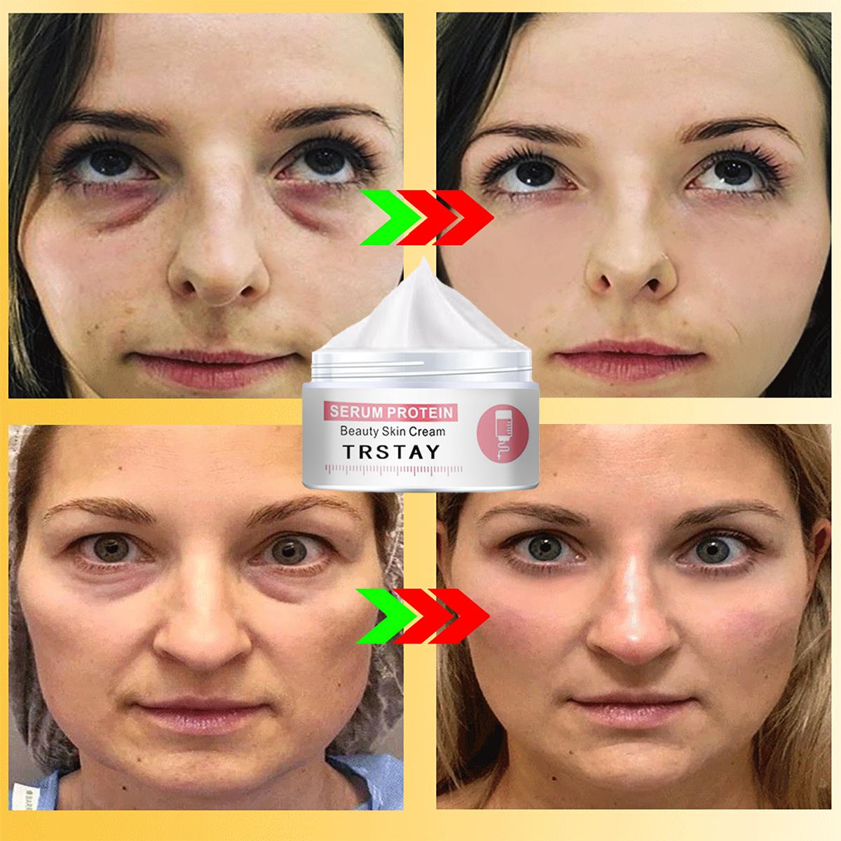 

5G/15G/30G/50G/Fade Eye Fine Lines Essence Cream для глаз Удаляет темные круги