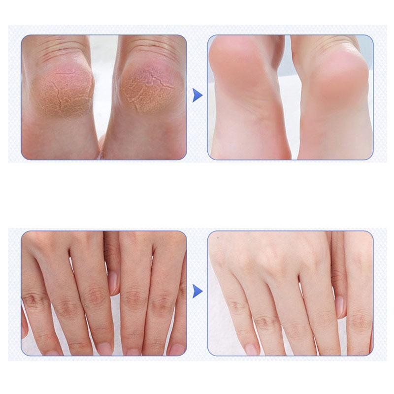 Images Hand and Foot Chapped Cream Nourishing Moisturizing Hand and Foot Cream