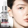Black Rice Peel Shot Ampoule-Brightens Skin Tone And Enhances Iuminosity-Suitable For All Skin Types, 30ml